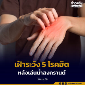 หลังเล่นน้ำสงกรานต์ เฝ้าระวัง 5 โรคยอดฮิต หากมีอาการรีบพบแพทย์