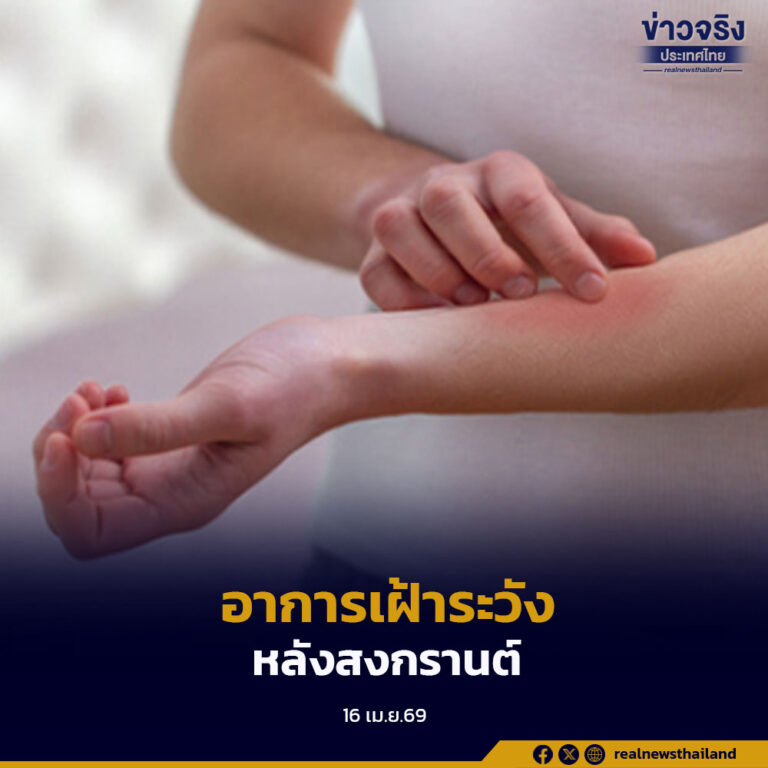 อาการเฝ้าระวังหลังสงกรานต์ แนะประชาชนสังเกตตัวเอง-บุตรหลาน ลดความรุนแรงของโรค ลดโอกาสแพร่กระจายเชื้อ