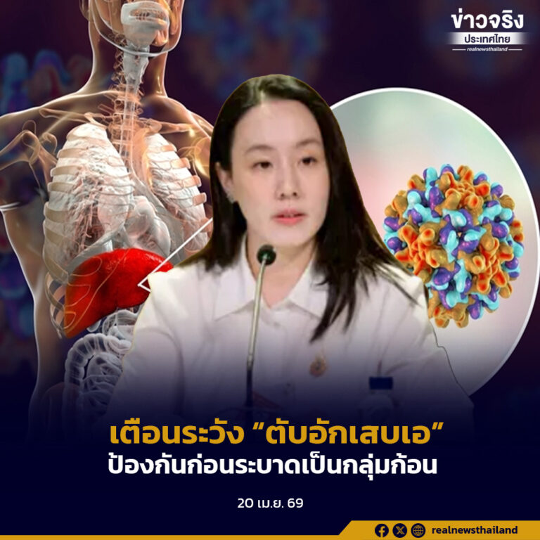 รัฐบาลเตือนเฝ้าระวัง “ตับอักเสบเอ” ย้ำคุมเข้มอาหาร–น้ำ ป้องกันก่อนระบาดเป็นกลุ่มก้อน