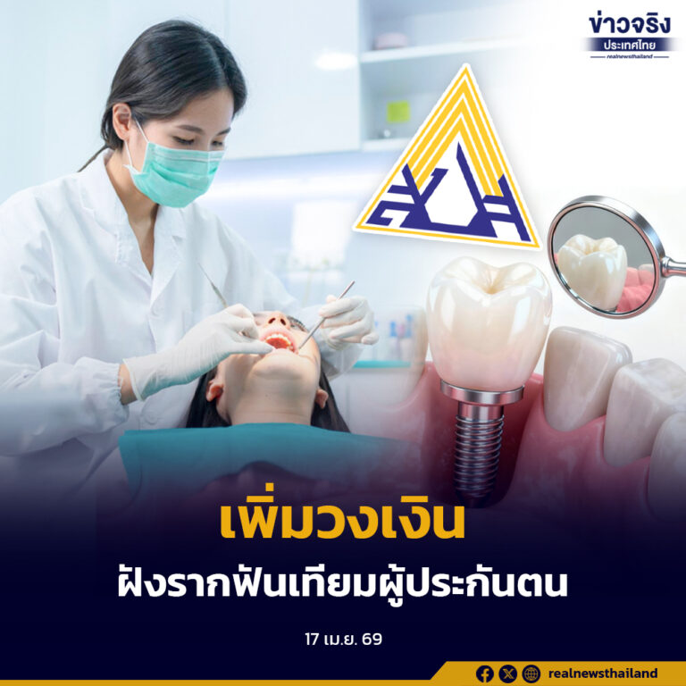 ปรับสิทธิทันตกรรมครั้งใหญ่ เพิ่มวงเงิน-ฝังรากฟันเทียม เริ่ม 1 พ.ค.นี้ ลดภาระค่าใช้จ่ายผู้ประกันตนทั่วประเทศ