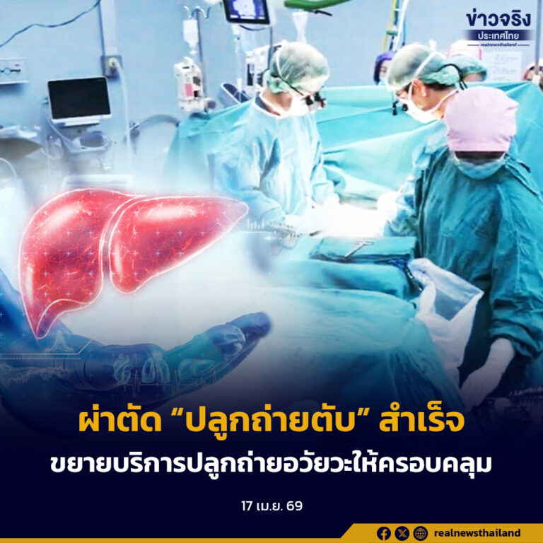 รพ.สรรพสิทธิประสงค์ “ปลูกถ่ายตับ” สำเร็จแห่งแรกของ สป.สธ. เปิดศูนย์ความเป็นเลิศขยายปลูกถ่ายอวัยวะให้ครอบคลุม
